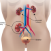 How Nasarawa’s hidden kidney trade targets desperate youth 